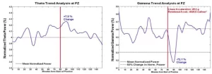 EEG graph showing sport concussion by expert witness Dr. John Lloyd